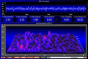 Brainwave, ondes cérébrales, EEG, méditation lampe Lucia N°3, Lucia light