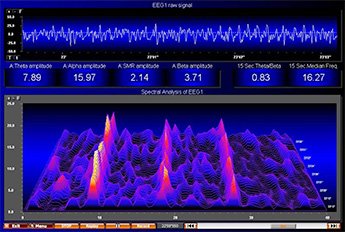Brainwave, ondes cérébrales, EEG, méditation lampe Lucia N°3, Lucia light